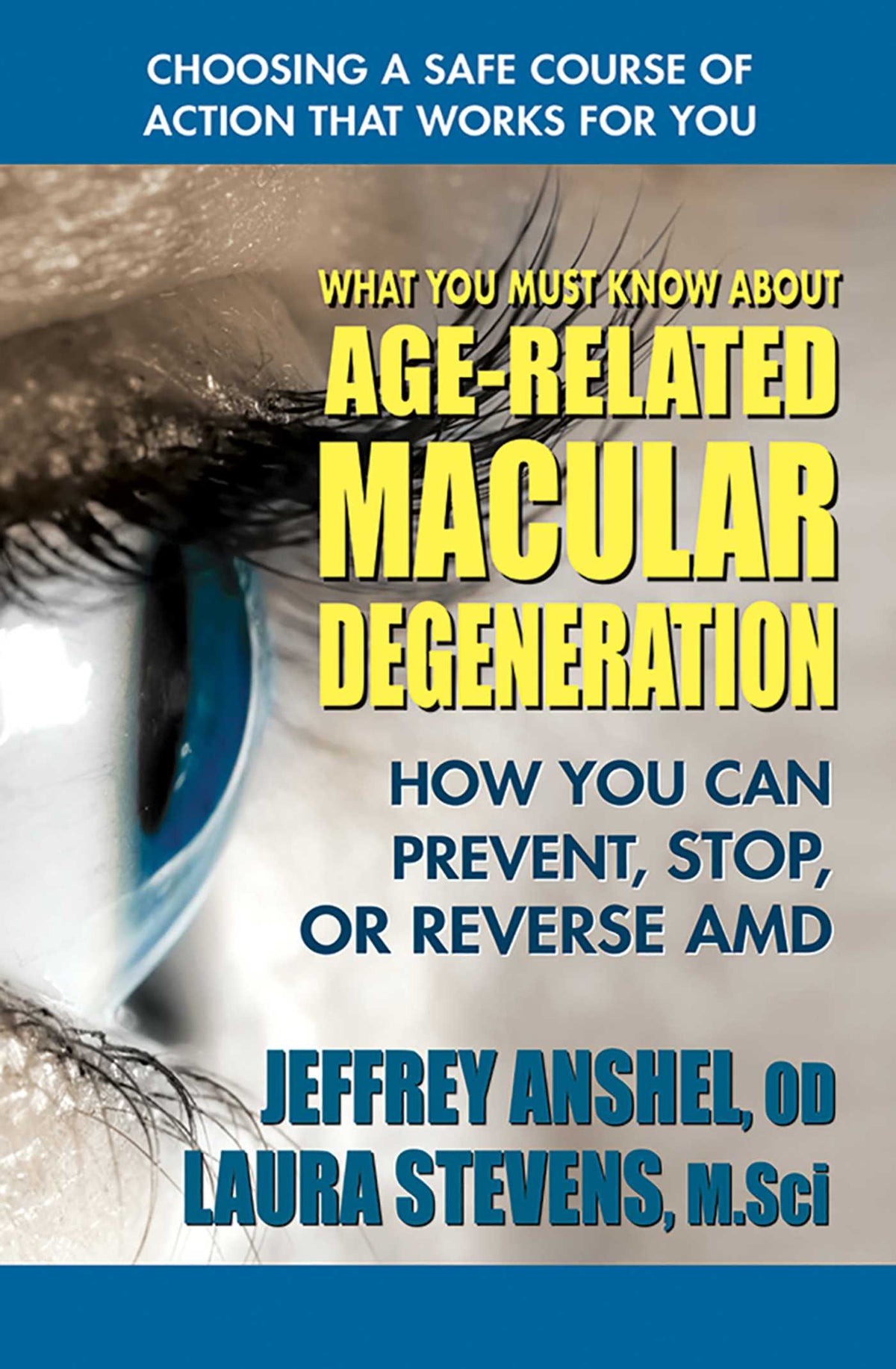 What You Must Know About Age-Related Macular Degeneration