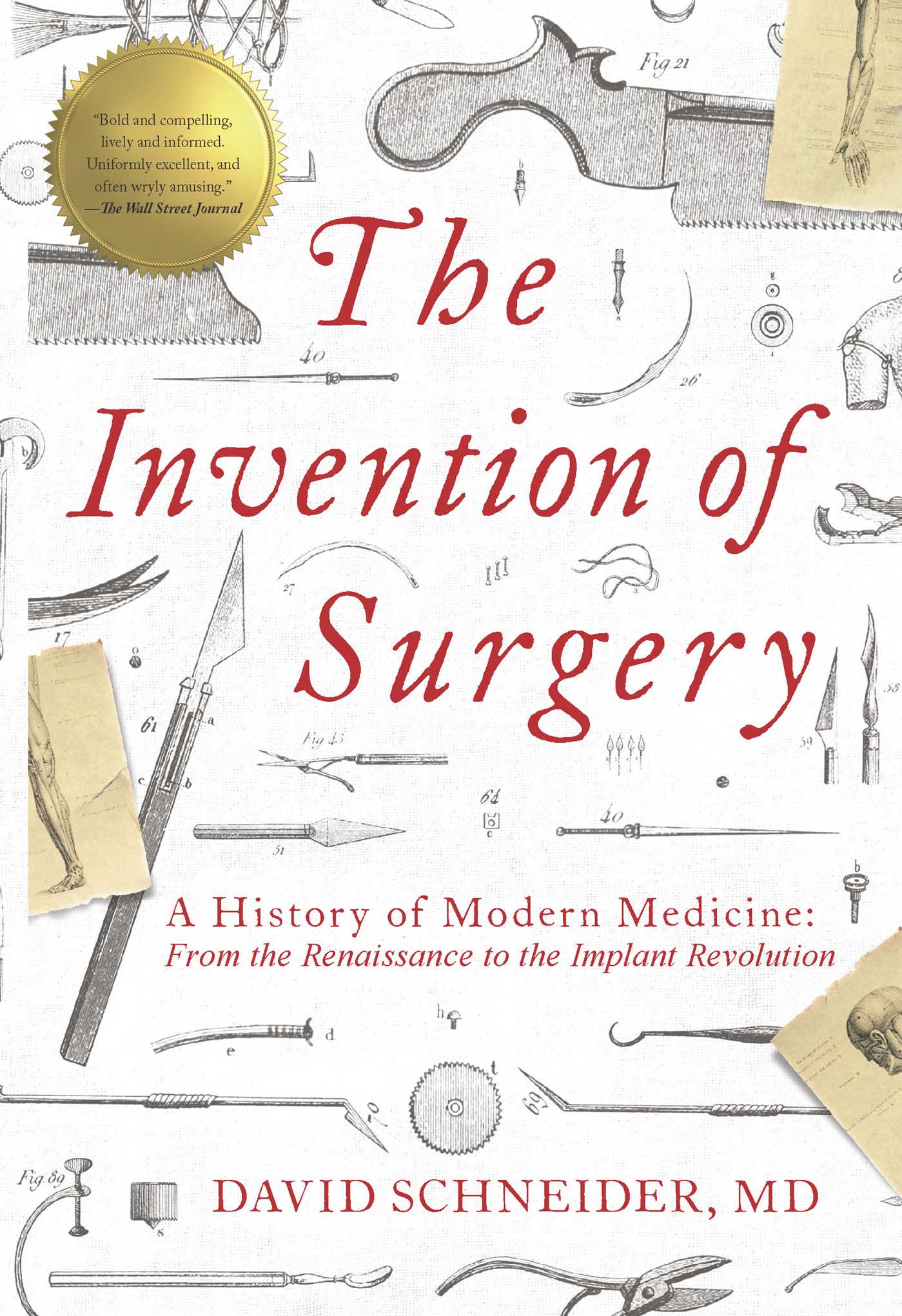 Invention of Surgery