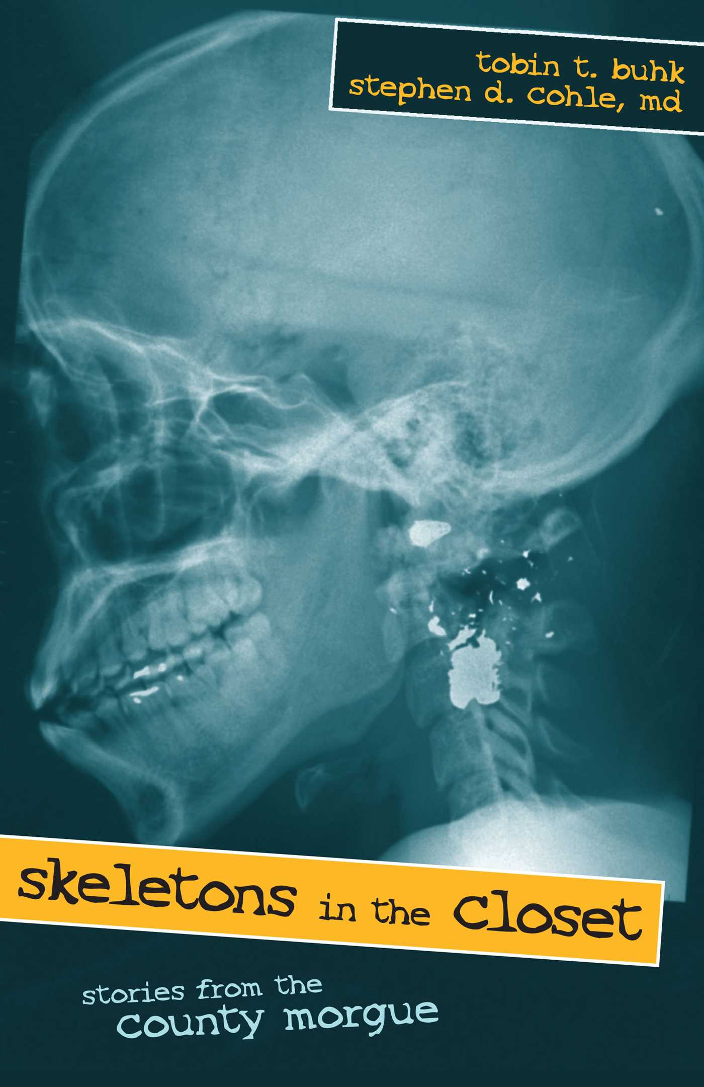 Skeletons in the Closet